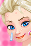 Ice Queen Acne Treatment